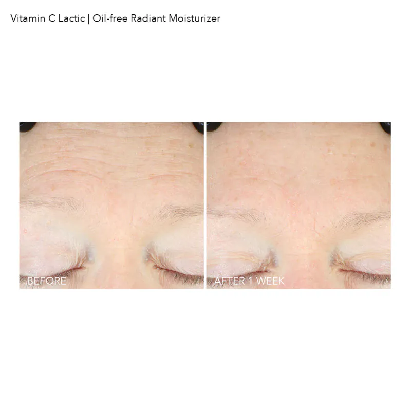Dr Dennis Gross Vitamin C + Lactic Oil-Free Radiant Moisturizer
