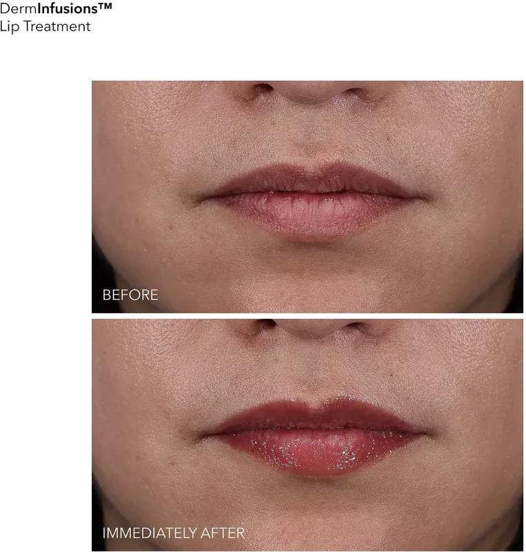 Dr Dennis Gross DermInfusions Plump + Repair Lip Treatment
